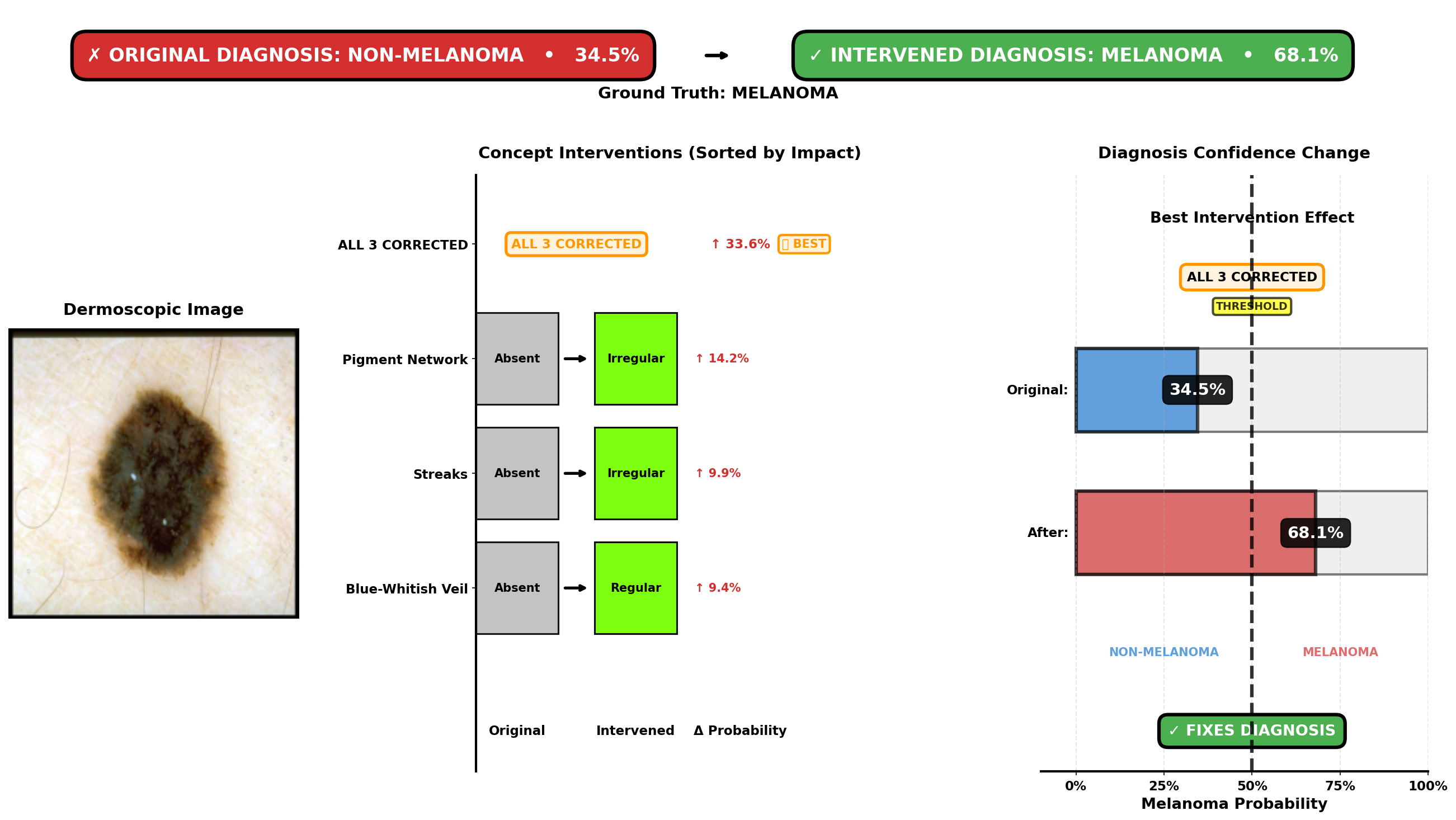 Intervention analysis for Case 578