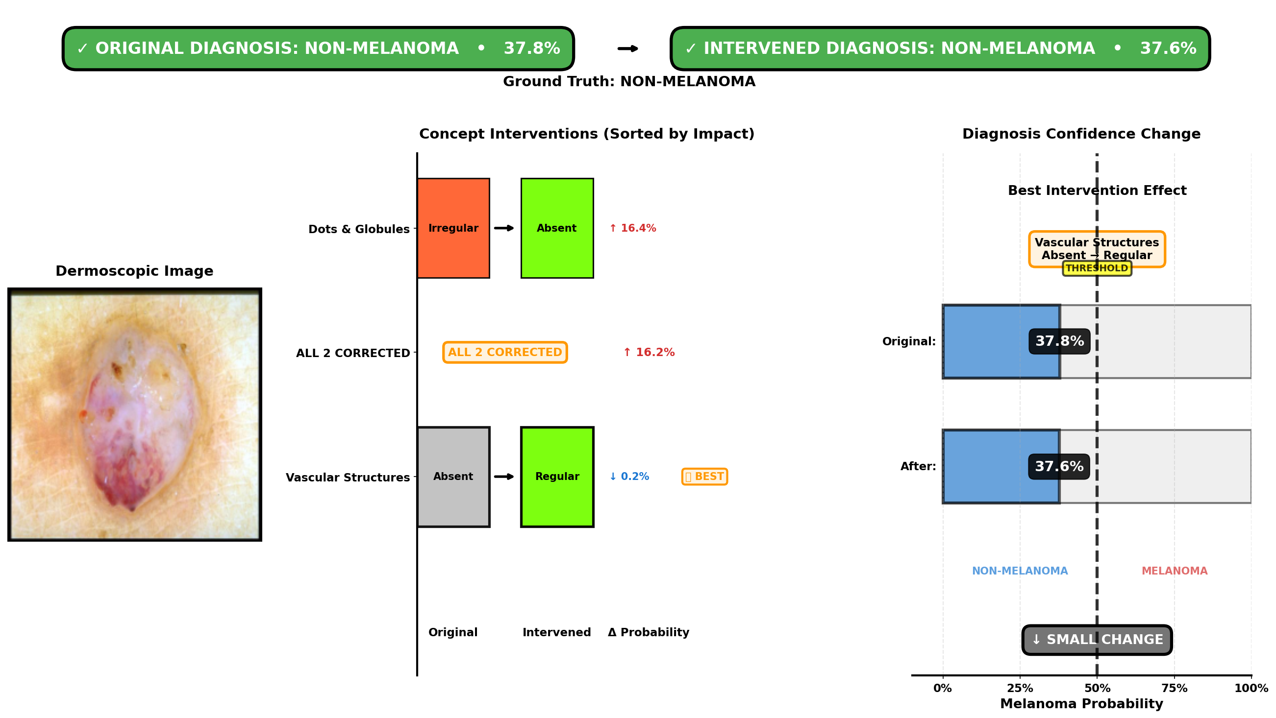 Intervention analysis for Case 7